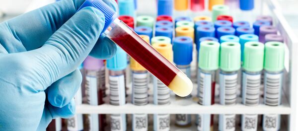 Пробирка с кровью в лаборатории - Sputnik Afrique