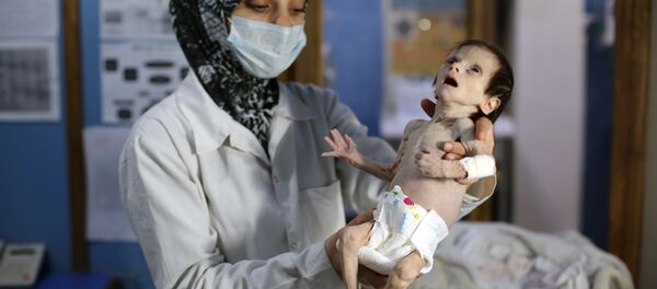 Un enfant syrien souffrant de malnutrition - Sputnik Afrique
