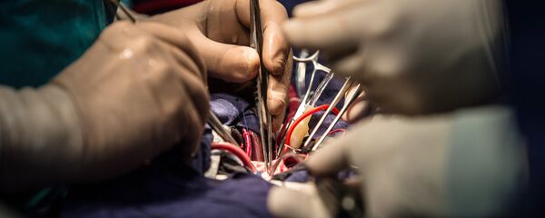 Greffe cardiaque - Sputnik Afrique