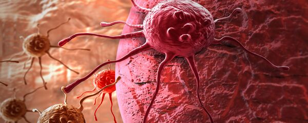 Cancer - Sputnik Afrique