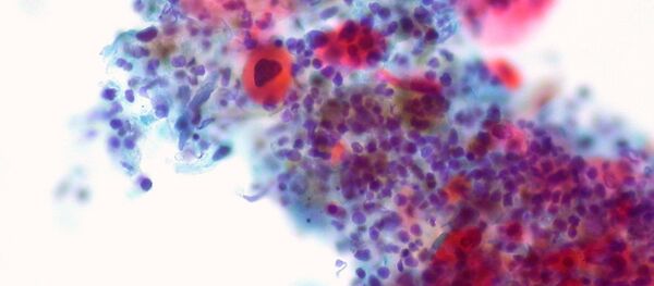 Des cellules cancéreuses (image d'illustration) - Sputnik Afrique