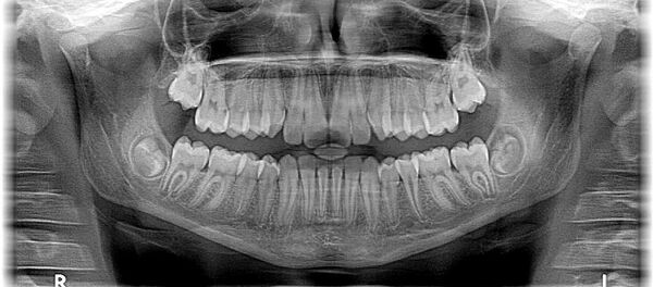Челюсть - Sputnik Afrique