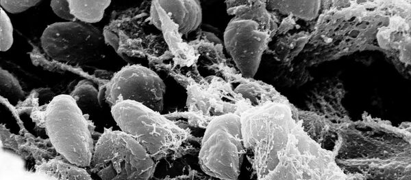 Peste bubonique - Sputnik Afrique