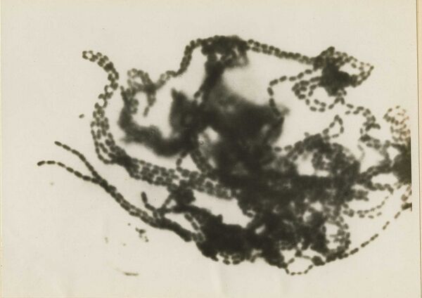 La poliomyélite - Sputnik Afrique