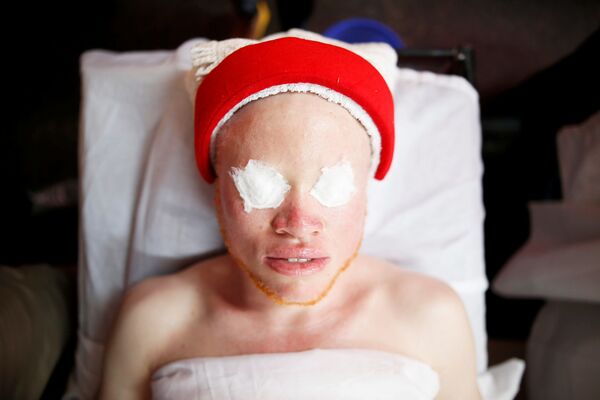 Un concours de beauté  d’albinos au Kenya - Sputnik Afrique