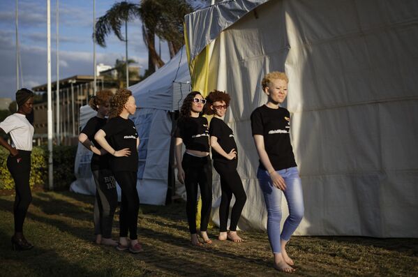Un concours de beauté  d’albinos au Kenya - Sputnik Afrique