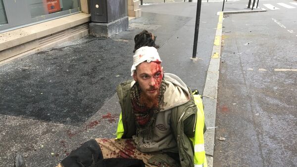 Un manifestant blessé à la tête avenue Monceau - Sputnik Afrique