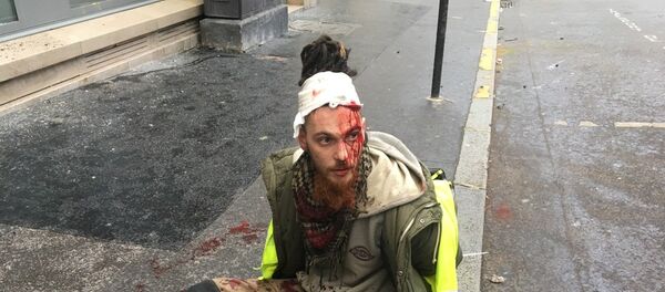 Un manifestant blessé à la tête avenue Monceau - Sputnik Afrique