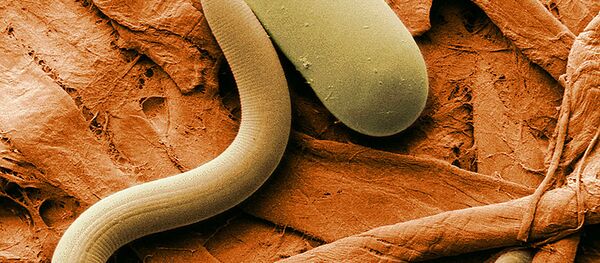 Soybean cyst nematode and its egg - Sputnik Afrique