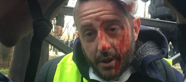 Un manifestant blessé lors de l'Acte 14 des Gilets jaunes à Paris - Sputnik Afrique