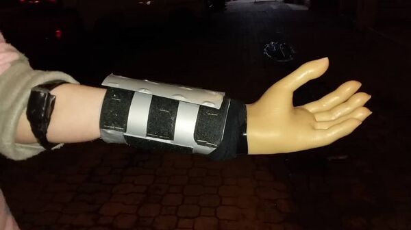 Un étudiant syrien a inventé une main électronique fonctionnelle et bon marché - Sputnik Afrique