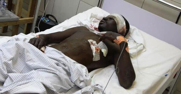 Hôpital à Maroua, après une attaque à la bombe au village de Mora, le 21 août 2006 - Sputnik Afrique