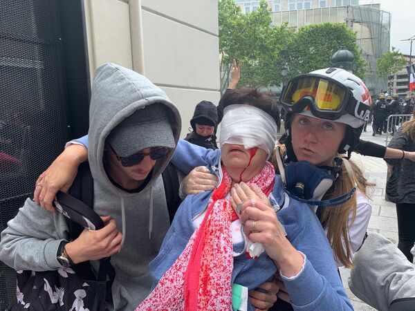Une femme grièvement blessée à l’œil sur les Champs-Élysées le 14 juillet - images Une femme grièvement blessée à l’œil sur les Champs-Élysées le 14 juillet - images - Sputnik Afrique
