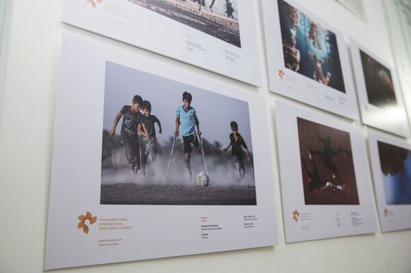 L'enfant irakien ayant perdu sa jambe débute son traitement en Russie - Sputnik Afrique