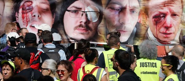 des photos des personnes éborgnées par un tir LBD - Sputnik Afrique