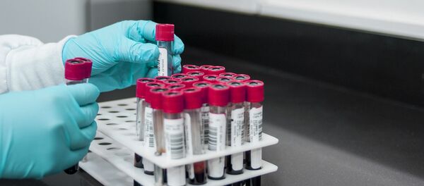 Un analyse de sang - Sputnik Afrique