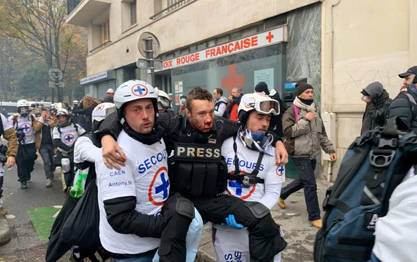 Journaliste blessé au visage pendant l'acte 53 des gilets jaunes, le 16 novembre 2019 Journaliste blessé au visage pendant l'acte 53 des gilets jaunes, le 16 novembre 2019 - Sputnik Afrique