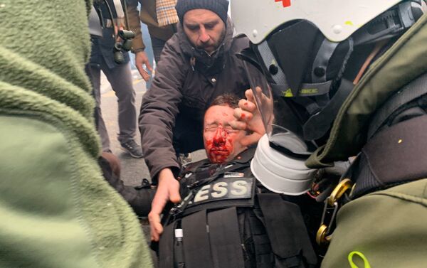 Journaliste blessé au visage pendant l'acte 53 des gilets jaunes, le 16 novembre 2019 - Sputnik Afrique