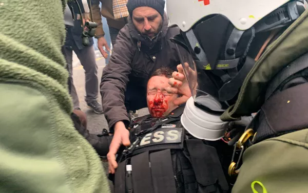 Journaliste blessé au visage pendant l'acte 53 des gilets jaunes, le 16 novembre 2019 Journaliste blessé au visage pendant l'acte 53 des gilets jaunes, le 16 novembre 2019 - Sputnik Afrique