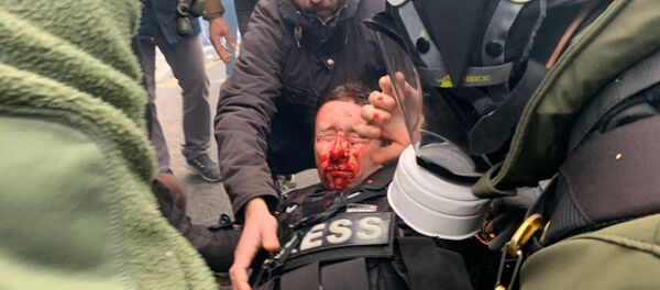 Journaliste blessé au visage pendant l'acte 53 des gilets jaunes, le 16 novembre 2019 - Sputnik Afrique