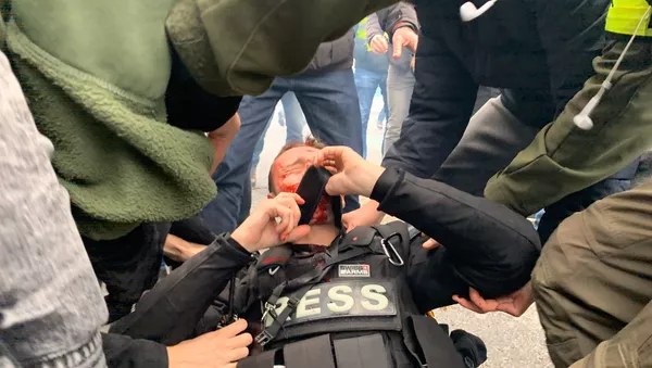 Journaliste blessé au visage pendant l'acte 53 des gilets jaunes, le 16 novembre 2019 - Sputnik Afrique