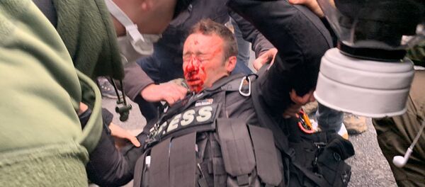 Journaliste blessé au visage pendant l'acte 53 des gilets jaunes, le 16 novembre 2019 - Sputnik Afrique