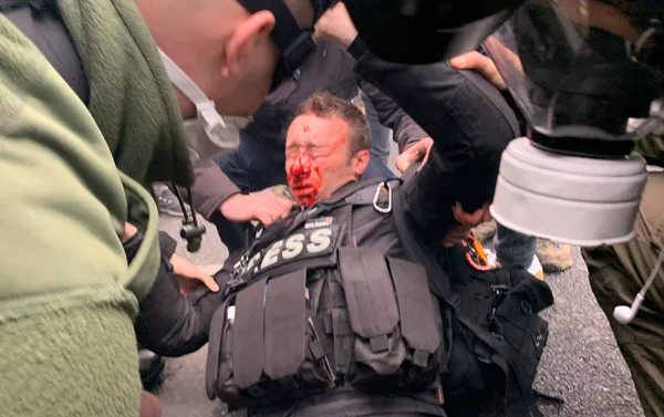 Journaliste blessé au visage pendant l'acte 53 des gilets jaunes, le 16 novembre 2019 Journaliste blessé au visage pendant l'acte 53 des gilets jaunes, le 16 novembre 2019 - Sputnik Afrique