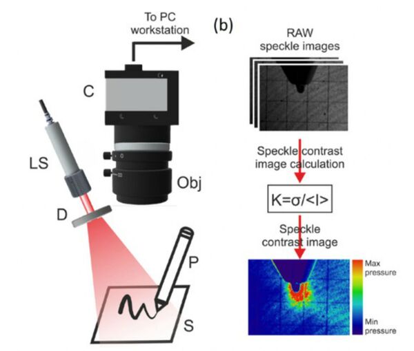 Un laser pour déchiffrer l'état psychique d'une personne à partir de son écriture - Sputnik Afrique