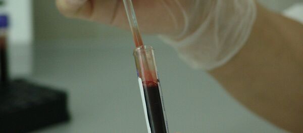 Un test sanguin Un test sanguin - Sputnik Afrique