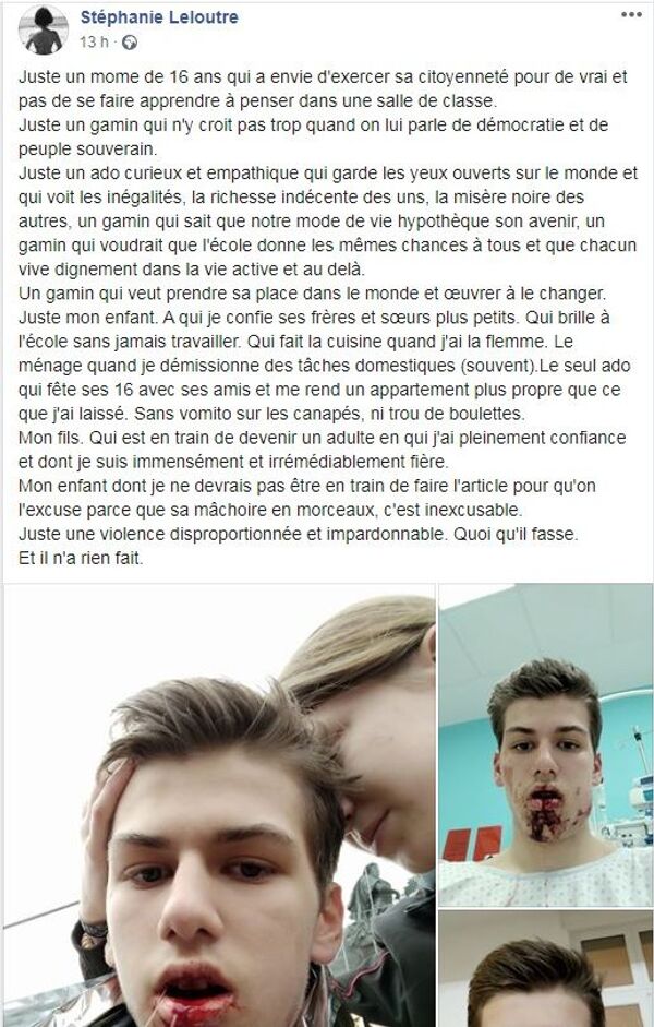 Un ado de 16 ans a la mâchoire brisée par un tir de LBD lors de l’acte 69 à Lyon – photo choc, vidéo Un ado de 16 ans a la mâchoire brisée par un tir de LBD lors de l’acte 69 à Lyon – photo choc, vidéo - Sputnik Afrique