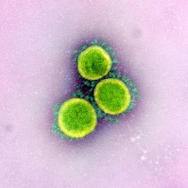 Le coronavirus du Covid-19 sous l’œil du microscope

 - Sputnik Afrique