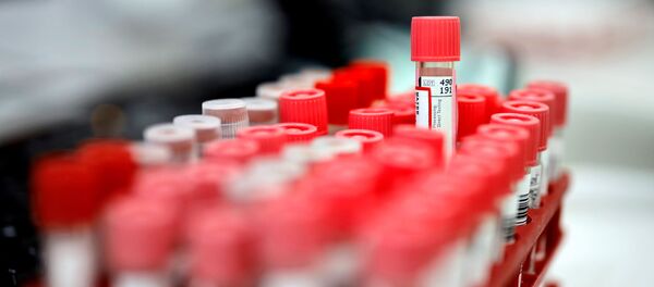 Un lot d'échantillons destiné à être testé au Covid-19 dans un laboratoire français. - Sputnik Afrique