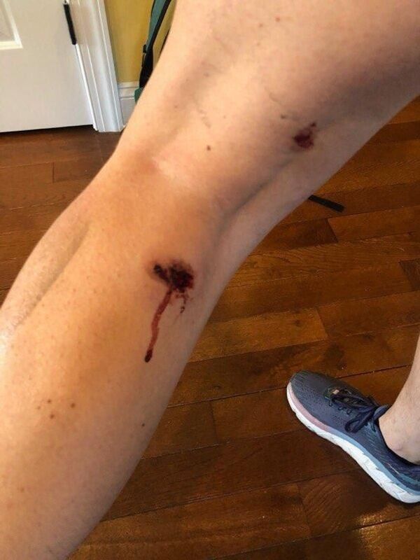 Une journaliste de Sputnik blessée par la police alors qu'elle couvrait une manifestation à Washington - vidéo - Sputnik Afrique