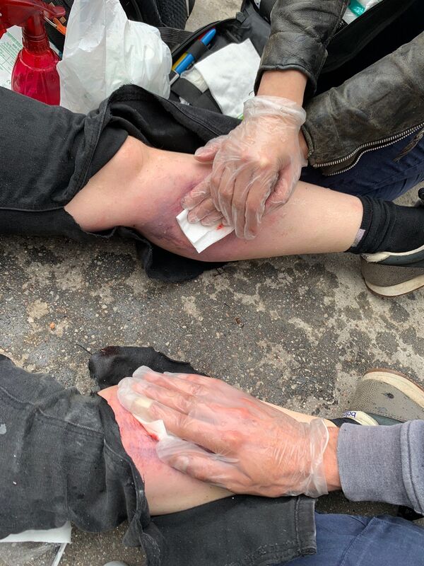 Une journaliste sérieusement blessée par une grenade en couvrant la marche des soignants à Paris - vidéo - Sputnik Afrique