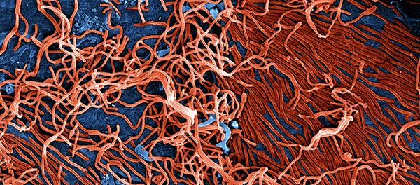 Частицы вируса Эбола - Sputnik Afrique